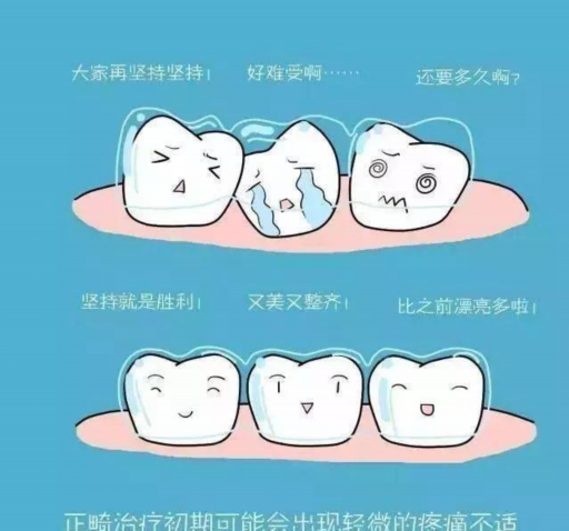全瓷牙和全瓷贴面哪个使用长（有谁门牙做过全瓷牙）(图1)